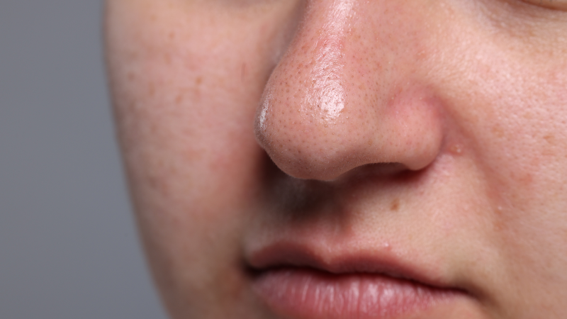 Las fosas nasales nos defienden del resfriado común y fijan la gravedad de la infección